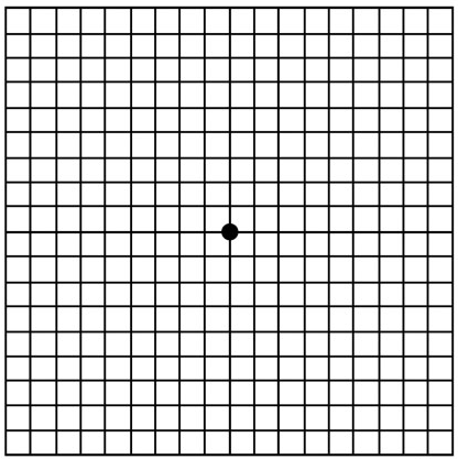 degeneracion macular
